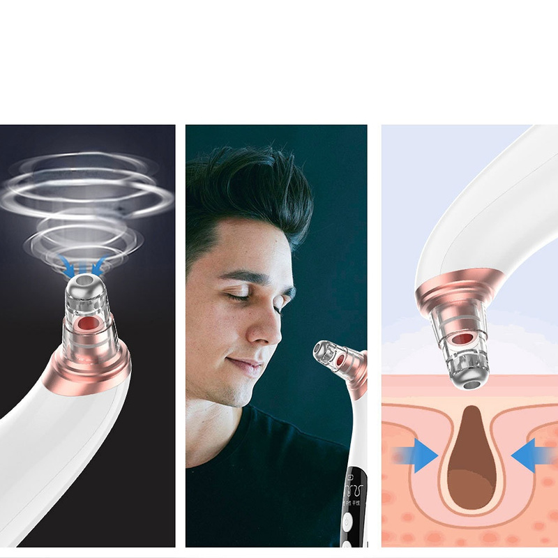 Skinclean Pro aspirateur d'imperfection visage avec caméra HD