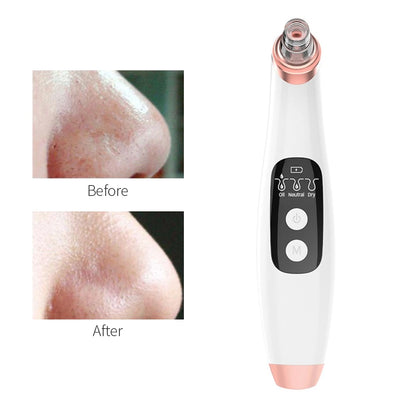 Skinclean Pro aspirateur d'imperfection visage avec caméra HD