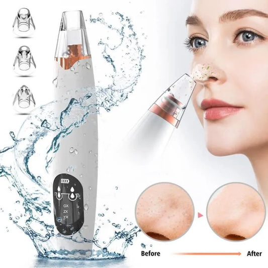 Skinclean Pro aspirateur d'imperfection visage avec caméra HD